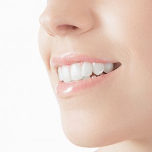Alessandra Spinetti sbiancamento dentale professionale Alessandra Spinetti sbiancamento dentale professionale